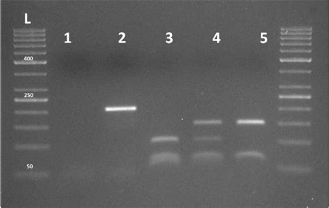 Figure 1 from Clinical characteristics and analysis of HFE gene ...