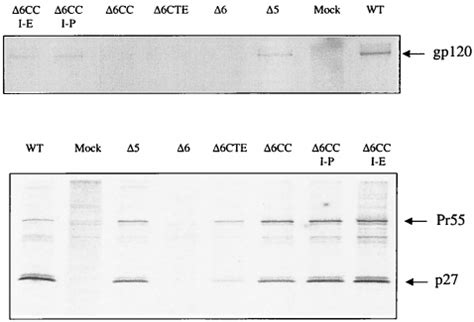 Identification of SIV gp120 and p27 antigens. COS-7 cells transfected ... 