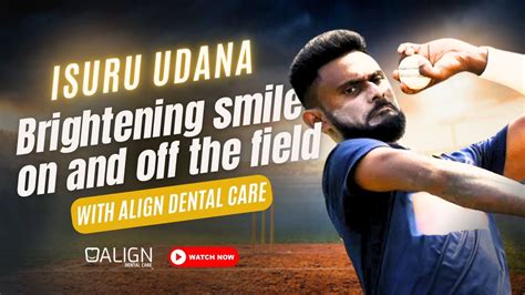 Isuru Udana Steps Up To The Crease For A Brighter Smile At Align Dental