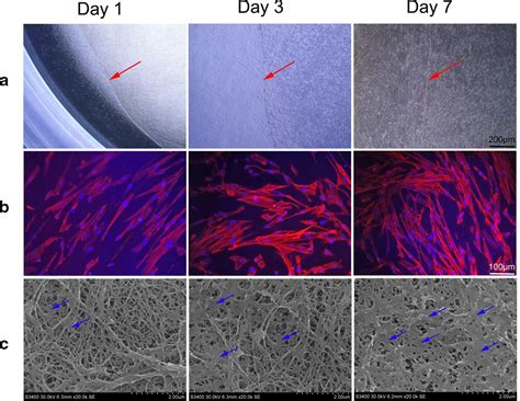 Human Acellular Amniotic Membrane Scaffolds Encapsulating Juvenile