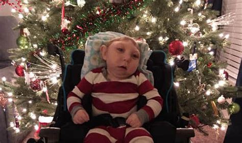 Baby born with half a head sends ENTIRE WORLD a heartwarming Christmas ...