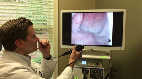 Ent Flexible Laryngoscopy Youtube