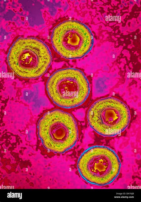 Herpes Genitale Immagini E Fotografie Stock Ad Alta Risoluzione Alamy