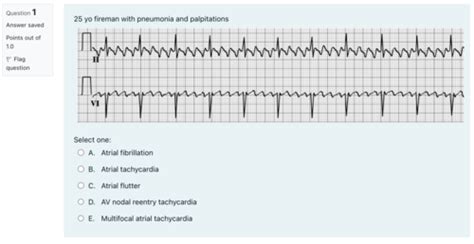 Arrhythmia Practice Exam SEB Not Required Flashcards Quizlet