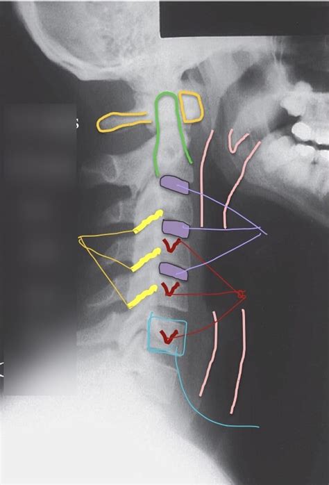 Radiograph 3 Diagram Quizlet