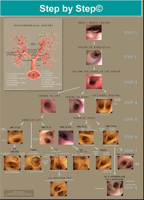 bronchoscopy step by step | Bronchoscopy International