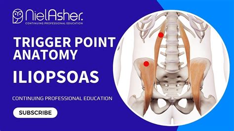 Exploring The Iliopsoas Understanding Trigger Point Locations For