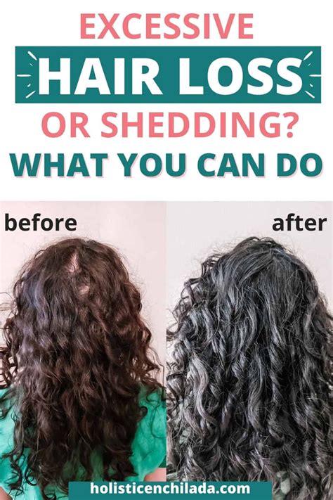 How To Tell The Difference Between Shedding And Hair Loss Venetta Meier