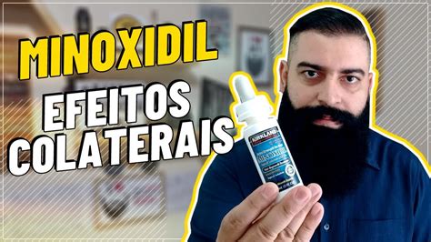 MINOXIDIL EFEITOS COLATERAIS I O QUE SABER ANTES DE USAR I SAIBA