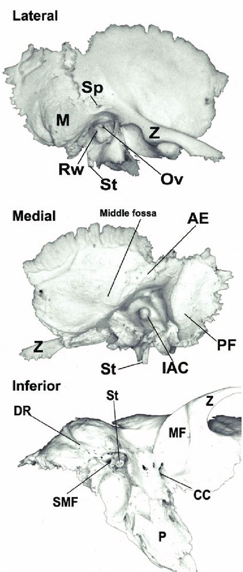 2 Surface Anatomy Of The Temporal Bone On The Lateral View The