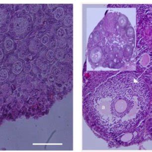 Microphotographs Of Dpp And Adult Mouse Ovaries Sections Were