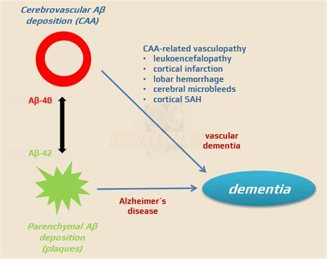 Cerebral Amyloid Angiopathy (CAA) | STROKE MANUAL