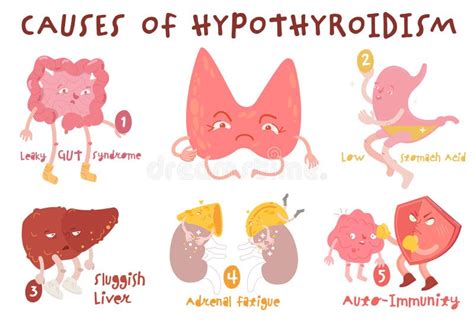 Causes Of Hypothyroidism Thyroid Gland Disease Endocrine System