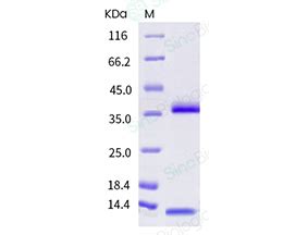 FCRN/FCGRT Protein Overview: Sequence, Structure, Function and Protein Interaction | Sino Biological