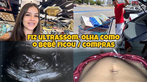 Comprei O Kit De Panela Que Eu Queria Fiz A Ultrassom Morfol Gica Vi