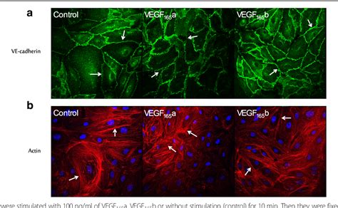 Figure From Vegf Isoforms Have Differential Effects On Permeability