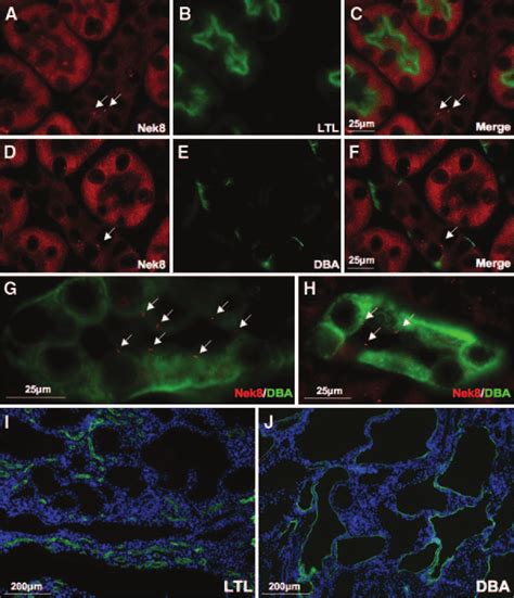 Ciliary Nek8 Are Found Only In Collecting Tubules And Collecting Ducts