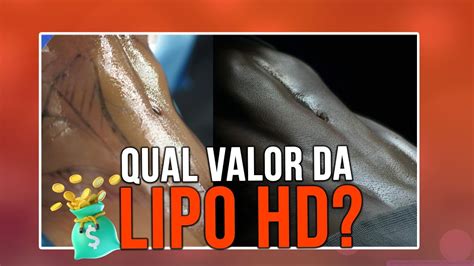 Qual O Valor De Uma Lipo - QUAL PREÇO DA LIPO HD - CIRURGIA PLÁSTICA - YouTube