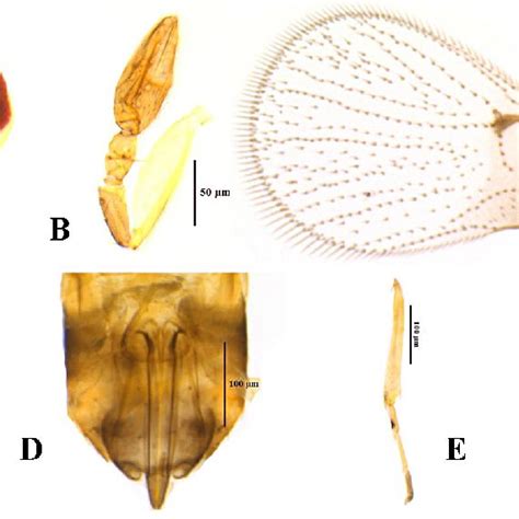 A E Trichogramma Hayati Sp N Female A Head B Antenna C Download Scientific Diagram