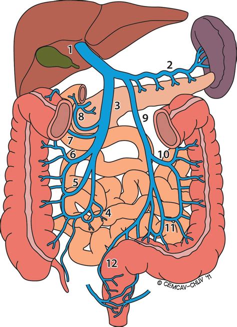 Multidetector Ct Features Of Mesenteric Vein Thrombosis Radiographics