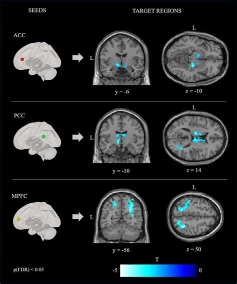 Results Of The Seed Based Connectivity Analysis Images Show Functional Download Scientific