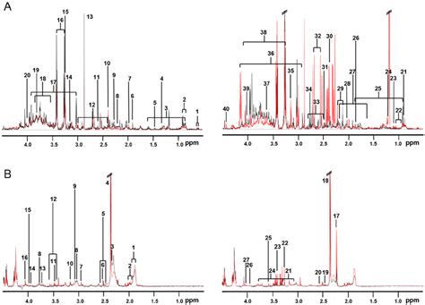 The Overlaid Representative 1 H NMR Spectra Of Urine A And Serum B