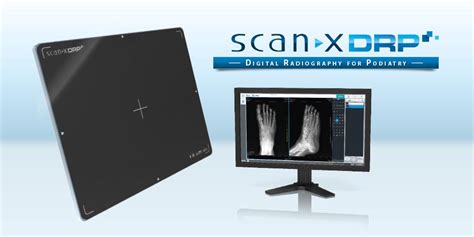 Podiatric DR System // ScanX DRP // Digital X-ray Imaging // ALLPRO Imaging