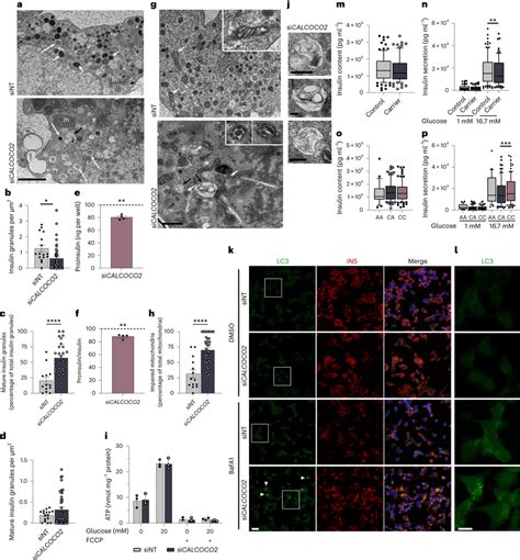 CALCOCO2 Regulates Insulin Granule Homeostasis Al SiCALCOCO2 Treated