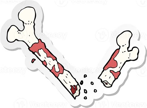 Sticker Of A Gross Broken Bone Cartoon 44971312 Png