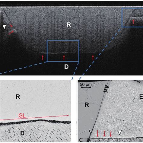 Representative Cross Sectional SS OCT Image And Corresponding CLSM