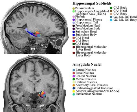 Hippocampal Subfields And Amygdala Nuclei Overlaid On Sagittal Top