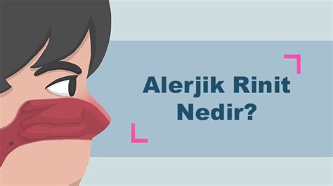 Alerjik Rinit Nedir