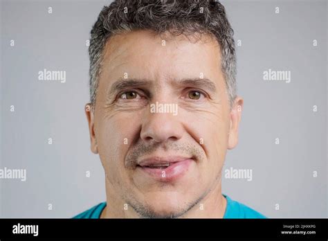 Bee stinging person hi-res stock photography and images - Alamy