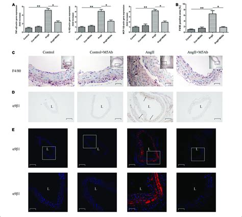 M Ab Attenuates Proinflammatory Cytokine Gene Expression And