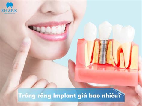 Trồng răng Implant giá bao nhiêu và thực hiện ở đâu uy tín