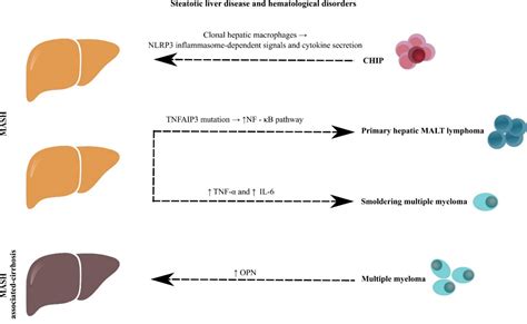 Steatotic Liver Disease In The Context Of Hematological Malignancies And Anti Neoplastic