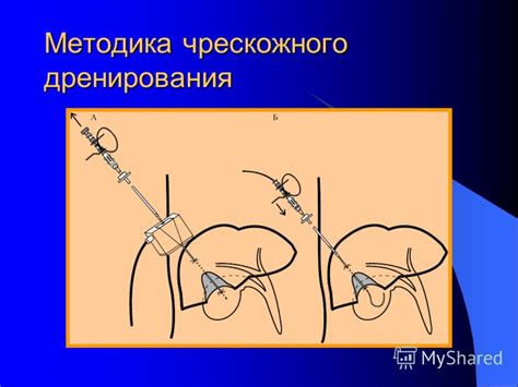 Презентация на тему: "ООО «МИНИМАЛЬНО ИНВАЗИВНЫЕ ТЕХНОЛОГИИ ...