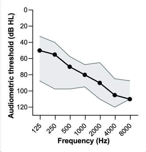 Median Audiometric Pure Tone Thresholds Gray Interquartile Distances