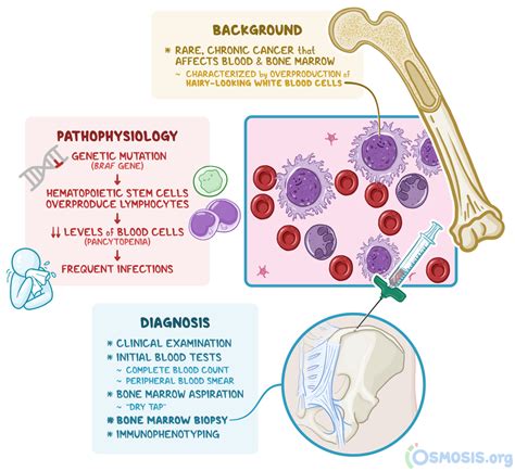 Hairy Cell Leukemia: What Is It, How Common Is It | Osmosis