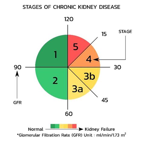 Egfr Kidney Disease Stages