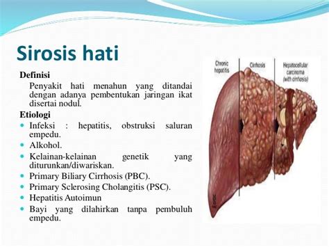 Kelainan pada hati