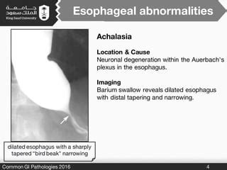 Common Gi Pathologies Ppt