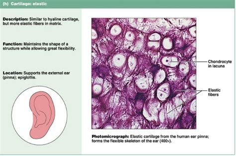 Fibrocartilage Under Microscope 400x Micropedia