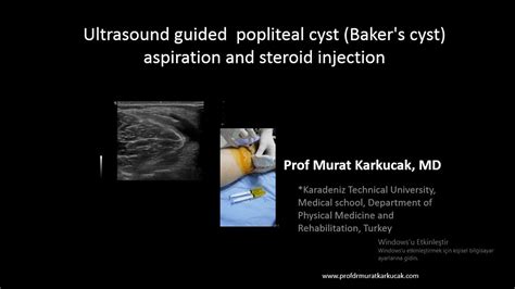 Ultrasound Guided Popliteal Cyst Baker S Cyst Aspiration And Steroid