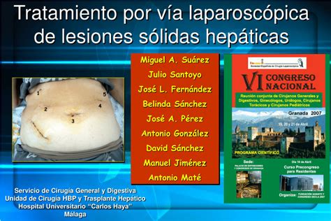 PDF RESECCIÓN LAPAROSCÓPICA DE LESIONES SÓLIDAS HEPÁTICAS