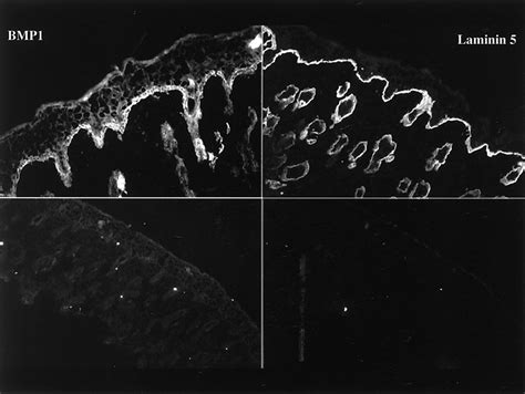 Bone Morphogenetic Protein 1 Is An Extracellular Processing Enzyme Of