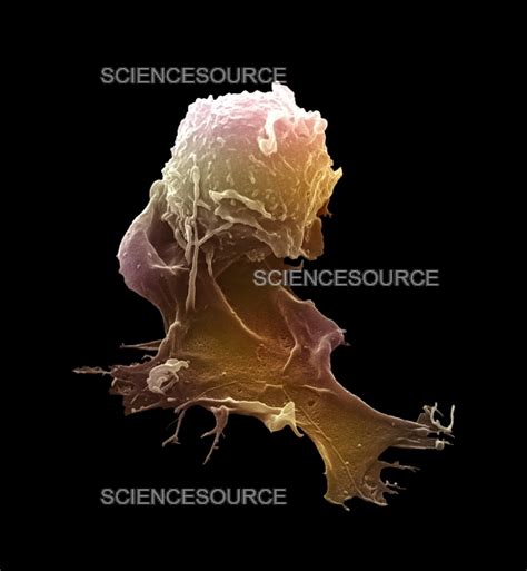 Macrophage Engulfing Bacteria Sem