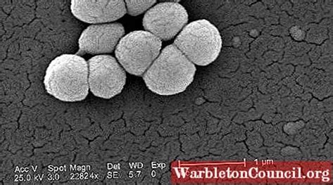 Micrococcus luteus: characteristics, morphology, diseases - science - 2025