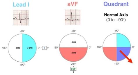 Ecg Axis Interpretation • Litfl Medical Blog • Ecg Library Basics