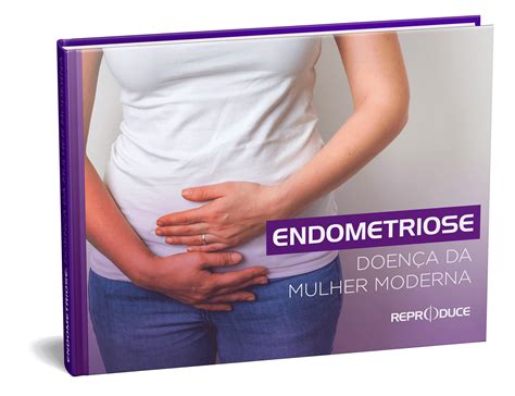 Endometriose Doen A Da Mulher Moderna Cl Nica Reproduce